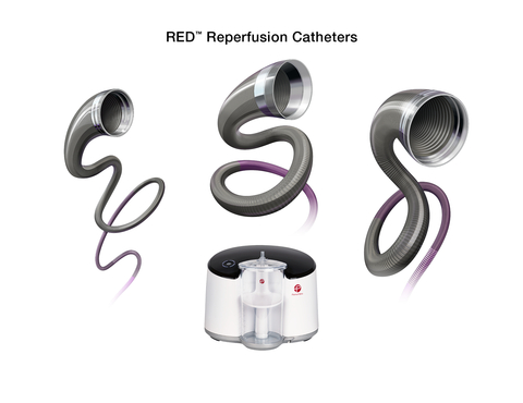 Penumbra's RED® Reperfusion Catheters are now commercially available in Europe. The catheters are part of the company's Penumbra System®, which is a fully integrated mechanical aspiration thrombectomy system designed to restore blood flow in acute ischemic stroke (AIS) patients. (Graphic: Penumbra)