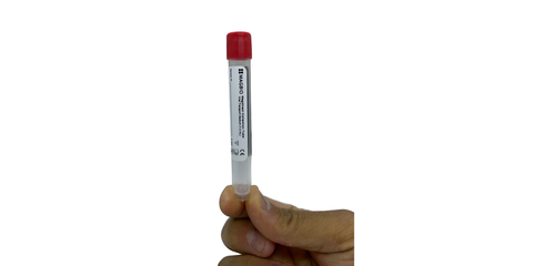 The new MagXtract Collection Tube from MagBio Genomics offers improved safety, stability and cost-effectiveness for sample collection and processing. Now available in the U.S. for COVID-19 testing and Europe for both COVID-19 and Influenza. MagXtract is the first FDA-cleared guanidine-free molecular transport medium that offers direct lysis and room temperature stability of RNA. The FDA has advised laboratory staff at COVID-19 sample processing facilities to avoid collection devices that use guanidine-based mediums because when cleaned with bleach, it creates cyanide gas that is highly toxic and can also be fatal. (Photo: Business Wire)