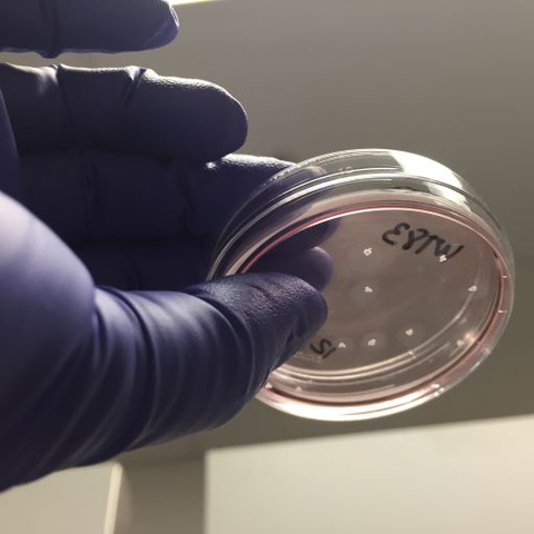 original Brain organoids in a petri dish, representative of research from Sierra Space and UC San Diego partnership to develop the first stem cell research institute in space. Photo credit: UC San Diego Health Sciences. (Photo: Business Wire)