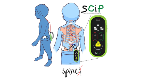 SCiP therapy for Cerebral Palsy (CP) (Photo: Business Wire)