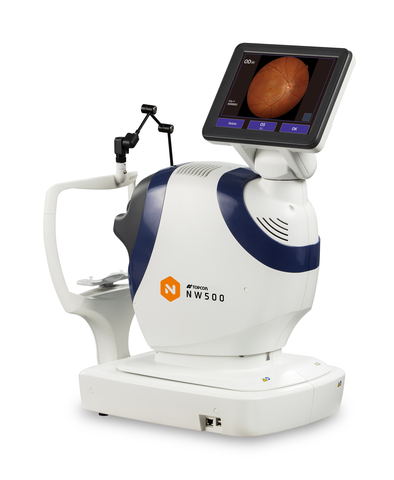 The new NW500 fully automated non-mydriatic retinal camera from Topcon. (Photo: Business Wire)