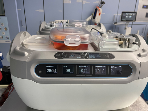 thumbnail The LifePort Kidney Transporter will be the exclusive provider of kidney preservation services at 7 transplant centers across Belgium. (Photo: Business Wire)
