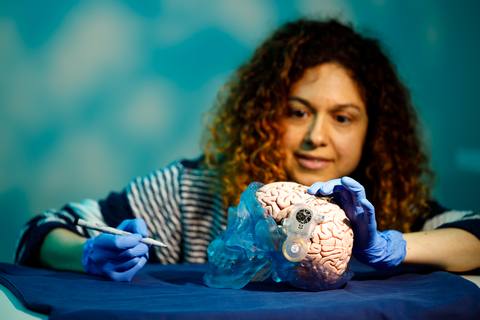 thumbnail ABILITY is a fully implantable neural recording system designed to amplify and wirelessly transmit high channel count, high frequency neural data from the brain to a computer in order to restore communication and independence for people with severe paralysis. ©Wyss Center