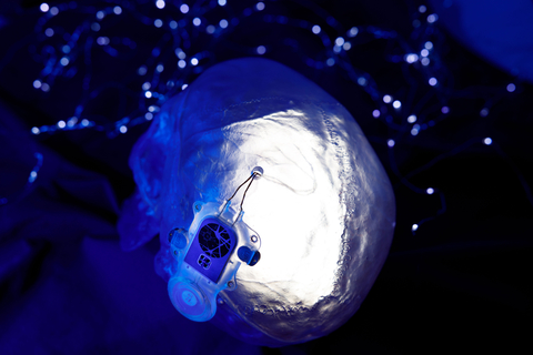 thumbnail ABILITY is a fully implantable neural recording system designed to amplify and wirelessly transmit high channel count, high frequency neural data from the brain to a computer in order to restore communication and independence for people with severe paralysis. ©Wyss Center