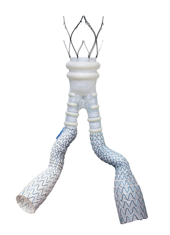 ALTO Abdominal Stent Graft System (Graphic: Business Wire)