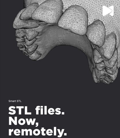 original https://dental-monitoring.com/smart-stl/ (Photo: DentalMonitoring)