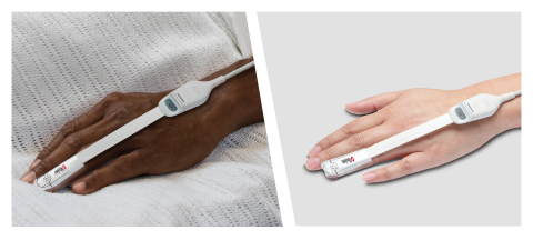 Masimo SET® Pulse Oximetry with RD SET® Sensors (Photo: Business Wire)