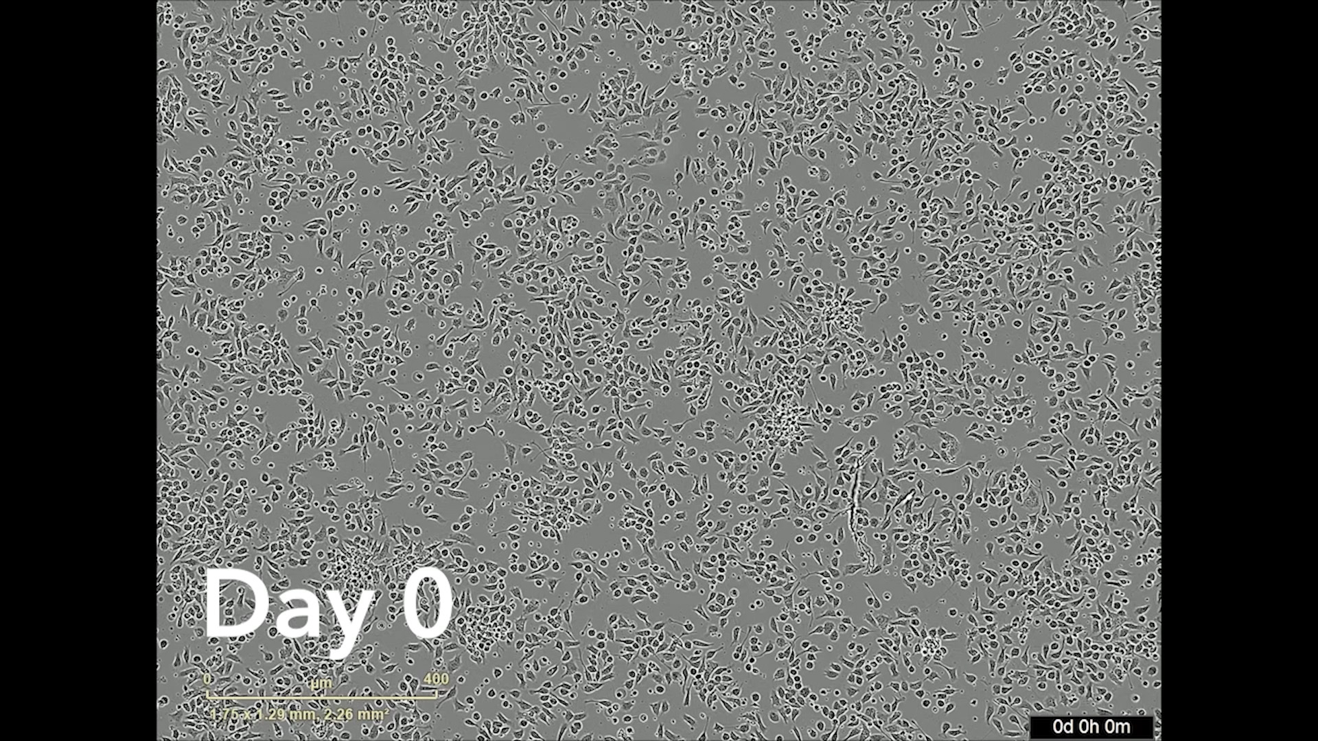 12-day time-lapse showing ioGABAergic Neurons forming complex neuronal networks after being thawed.