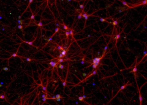 Image of ioGlutamatergic Neurons MAPT P301S demonstrating the cells have a defined glutamatergic neuron identity through the staining of protein markers with fluorescent antibodies (Graphic: Business Wire)
