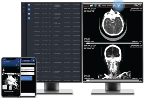 Screen shots of Viz Radiology Suite including worklist and PACS integration (Graphic: Business Wire)