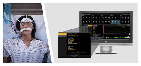 original Masimo Patient SafetyNet™ with Sepsis Index (Si™) (Photo: Business Wire)