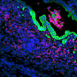 NanoString’s CosMx Spatial Molecular Imager Recognized By The Scientist ...