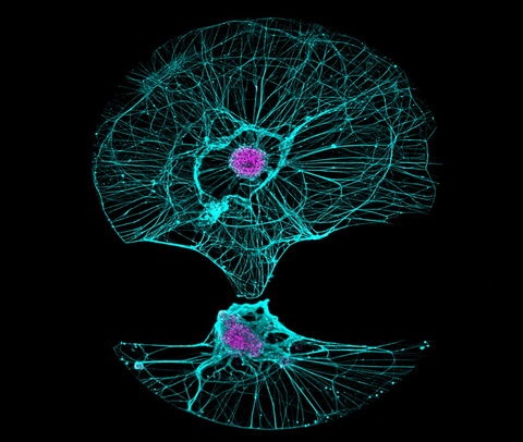 Fujifilm iCell Motor Neurons stained with Hoechst to identify nuclei (magenta) and with anti-Tuj1 to label neurites (cyan), imaged with a Yokogawa CQ1 automated microscope. (Photo: Business Wire)