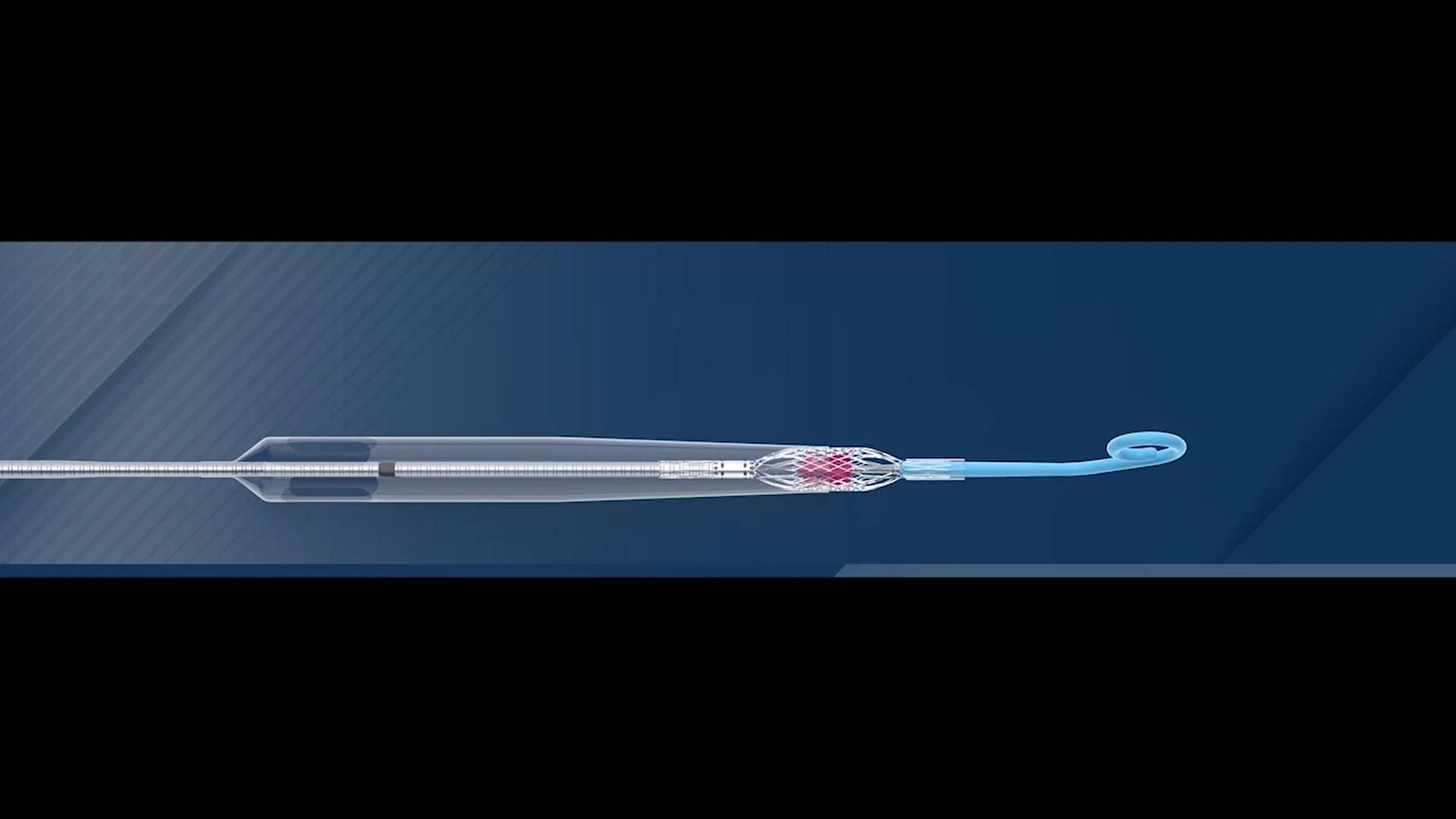 Impella ECP is the world’s smallest heart pump and the only heart pump compatible with small bore access and closure techniques.