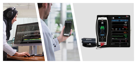 thumbnail Masimo Patient SafetyNet™ with Replica® and Root® (Graphic: Business Wire)