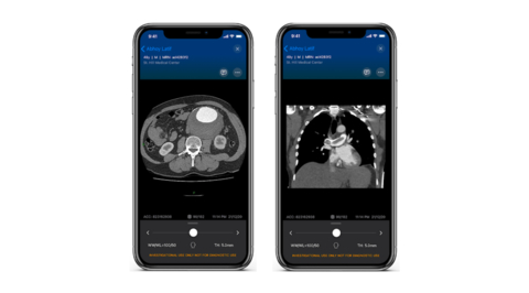 thumbnail Viz™ Vascular Suite (Photo: Business Wire)