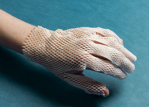 Kerecis’ new GraftGuide Mano is fish skin designed to treat burns on the hand. The wound-treatment product can easily cover the 3D structure of the hand, so surgeons do not have to tailor the graft, reducing the need for multiple grafts and bulky fixation, and minimizing surgical time. (Photo: Business Wire)