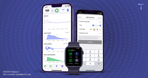 Image of Tidepool Loop interface on iPhone and Apple Watch (Graphic: Business Wire)