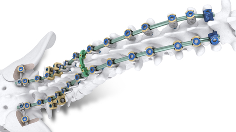 Image of the Mariner Deformity Pedicle Screw System for complex adult deformity spine cases. (Photo: Business Wire)