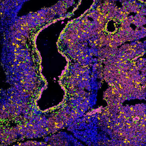 Resolve Biosciences Molecular Cartography™ technology was used to spatially resolve distinct cell populations by using specific gene markers in the perivascular niche microenvironment in a mouse primary melanoma tumor. Image courtesy of Jean-Christophe Marine, Laboratory for Molecular Cancer Biology, VIB-KU Leuven.