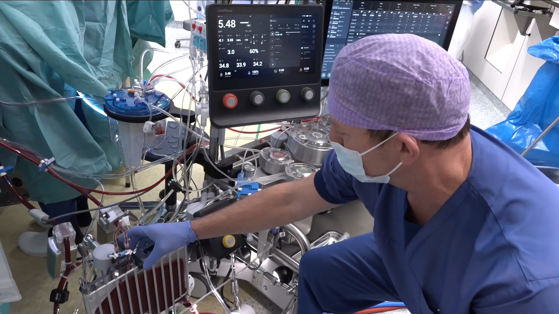 First clinical case with Essenz™ Perfusion System, at Catharina Hospital, Netherlands.
