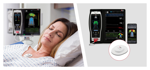 Masimo Centroid® with Root® and Replica® (Photo: Business Wire)
