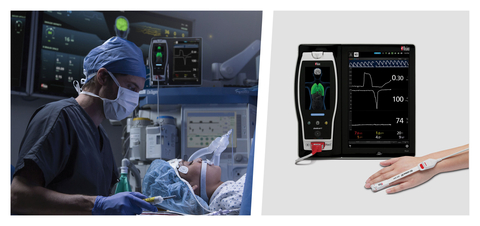 original Masimo Root® with ORi™ (Photo: Business Wire)