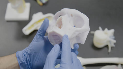 Anatomic 3D-printed models allow medical staff to practice and plan for surgeries. (Photo: Business Wire)