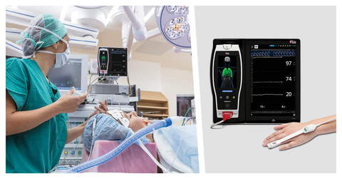 thumbnail Masimo Root® with PVi® (Photo: Business Wire)