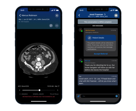 thumbnail Viz AAA is the first FDA-cleared AI-powered solution for the detection and triage of suspected AAA. (Photo: Business Wire)