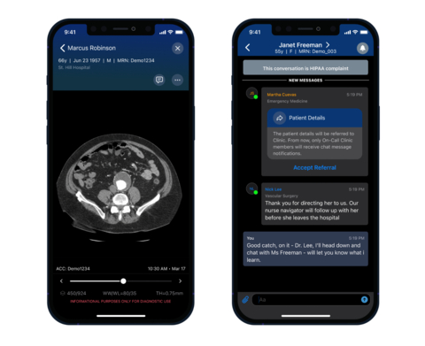Viz AAA is the first FDA-cleared AI-powered solution for the detection and triage of suspected AAA. (Photo: Business Wire)