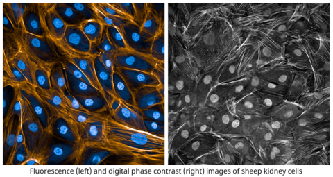 Fluorescence (left) and digital phase contrast (right) images of sheep kidney cells (Photo: Business Wire)