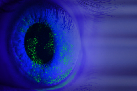 thumbnail ESSENCE-2 demonstrated that CyclASol improved total and central corneal staining within 2 weeks (Photo: Business Wire)