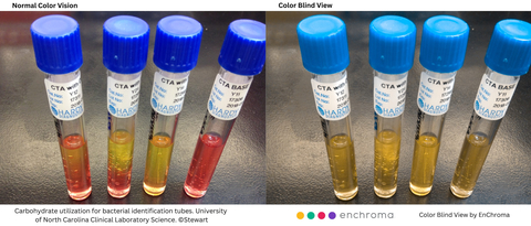 Color blind and color normal views of Carbohydrate Utilization for Bacterial Identification Tubes at the University of North Carolina's Clinical Laboratory Science, illustrating the potential for "color confusion" for a color blind student. (Photo: Business Wire)