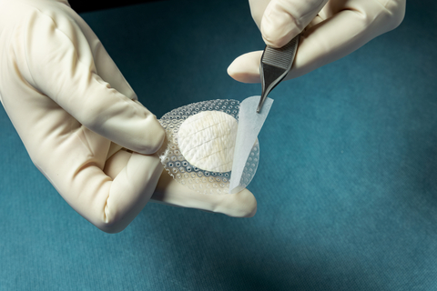 Kerecis MariGen® Shield integrates the company’s proven fish-skin grafts with a silicone contact layer for treating chronic and complex wounds. (Photo: Business Wire)