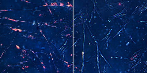 Senolytics are an emerging class of investigational drug compounds that selectively kill aging-associated senescent cells (left, with red stain) without affecting other cells (right). Using artificial intelligence, researchers from Integrated Biosciences have, for the first time, identified three senolytics with comparable efficacy and superior drug-like properties relative to leading investigational compounds. (Photo: Business Wire)