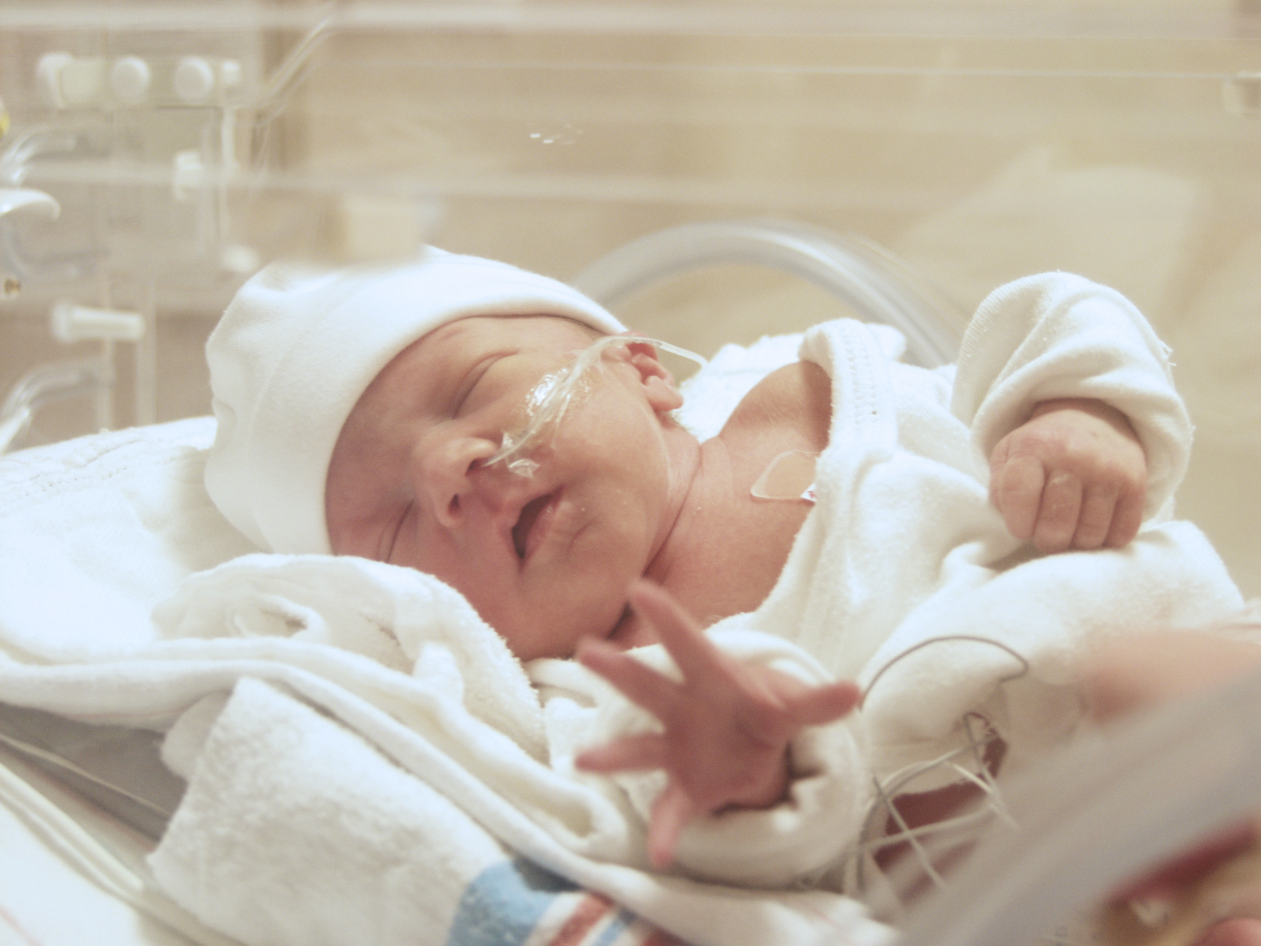 2 недели от рождения. Асфиксия новорожденных. Асфиксия для новорожденных и недоношенных. Асфиксия новорожденных кювез. Новорожденные дети.