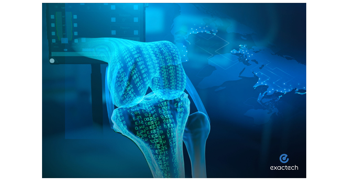 Exactech Protocol Exactech Accelerates International Expansion of Its Newton™ Balanced ...
