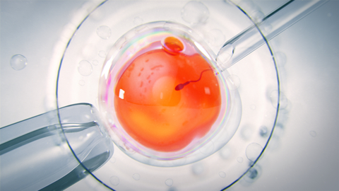 Oma Fertility Sperm InSight (TM) Technology (Photo: Business Wire)