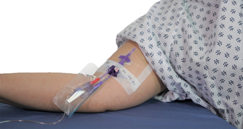 original IV Clear® dressing applied to an IV insertion site, and VALGuard® applied to a line connection. Contamination of IV setups is a common source of catheter-related bloodstream infections and require special handling procedures and protection to minimize health risks to patients. (Photo: Business Wire)
