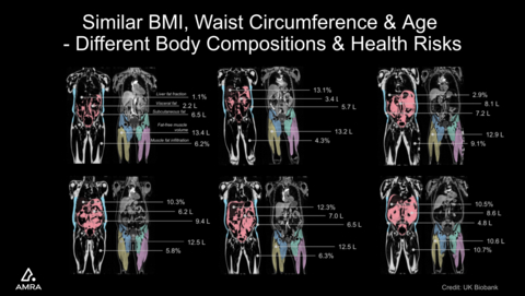 The study results highlight the need for personalized medicine and going beyond just the BMI