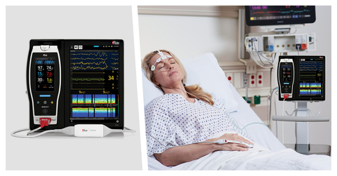 Masimo Root® with SedLine® Brain Function Monitoring (Photo: Business Wire)