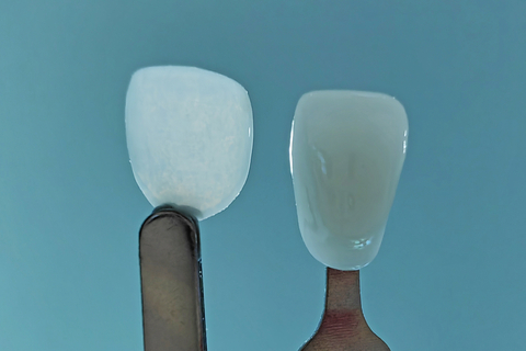 UltraThinner (left) next to a conventional veneer (right). (Photo: Business Wire)