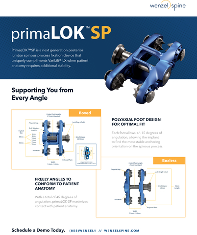 primaLOK SP's polyaxial technology provides for optimal placement and enhanced fixation to accommodate anatomic variations with minimal disruption to anatomy. (Graphic: Business Wire)