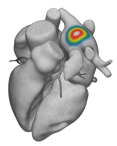 vMap's enhanced heart model offers a more detailed representation of the heart, significantly improving visualization and elevating the quality of analysis and interpretation. (Graphic: Business Wire)