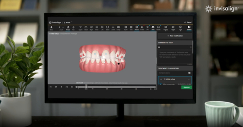 original SmartForce™ attachment-free aligner activation feature automatically applied and displayed in a ClinCheck® plan. (Photo: Business Wire)