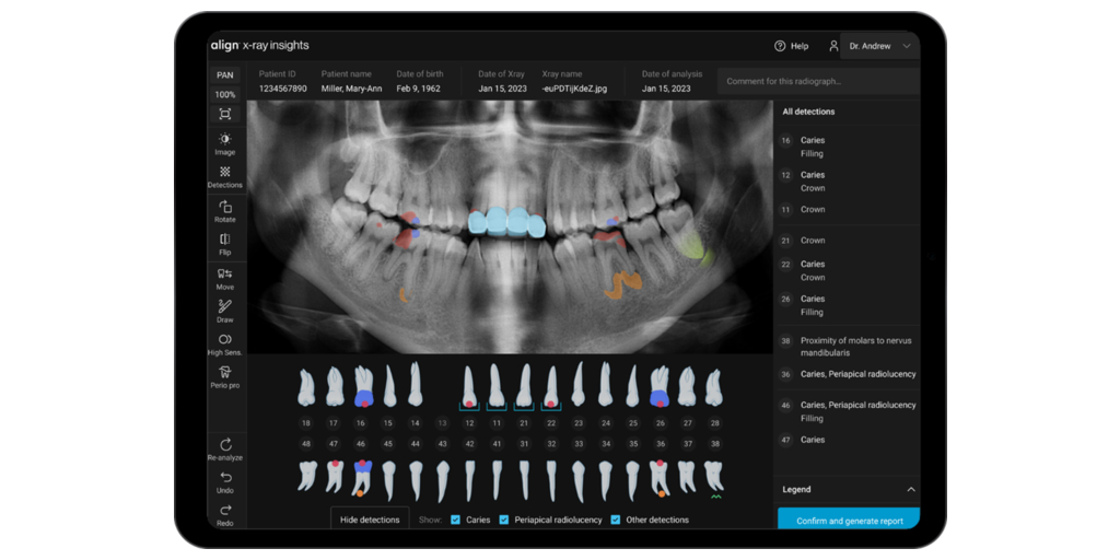 Align Technology on X: The #InternationalDentalShow started today, and we  are excited to bring our latest innovations and the Align Digital Platform  to over 30,000 Invisalign trained dentists attending #IDS2021 in Cologne –