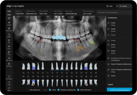 Align Technology Announces New iTero Lumina™ Intraoral Scanner