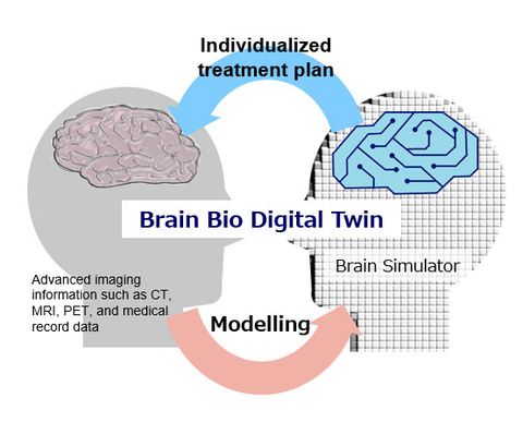 Figure 1: The Concept of Brain Bio-Digital Twin (Photo: Business Wire)
