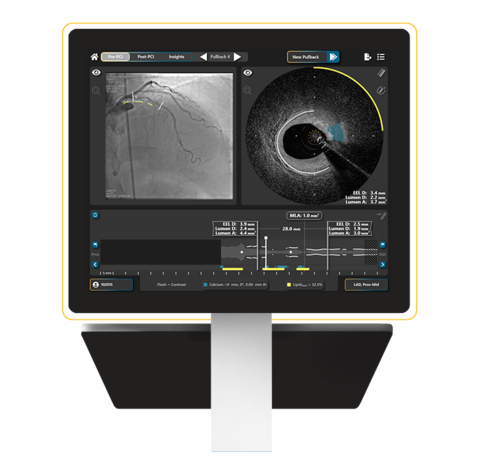 HyperVue Imaging System display. Next generation DeepOCT and Near Infrared Spectroscopy intravascular imaging system now includes compatibility with contrast-free saline imaging, advanced artificial intelligence algorithms to identify calcium and external elastic lamina, and hands-free angiographic co-registration. (Photo: Business Wire)